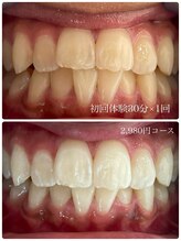 ホワイトニングスタイル 柏店/初回体験ホワイトニング30分照射