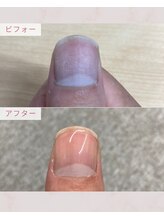 ふっとけ庵/爪ケア
