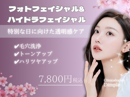 ディンプル(Dimple)の写真