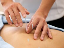 エウーゴ整骨院の雰囲気（身体の深部にアプローチし、不調の原因に向き合う本格鍼灸施術）