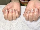 定額ネイル