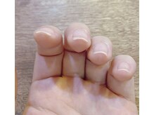 アモーレ プラス トゥエンティフォー(Amore +24)/爪のアーチありますか？