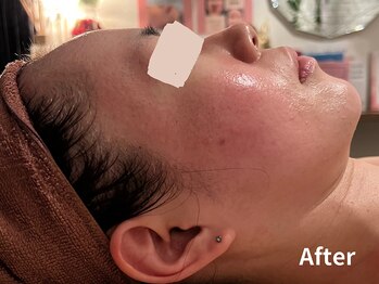 ダイヤモンド リーエンダ(Diamond leende)/クレイハーブピーリング