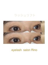 リノ(Rino)/ラッシュリフト