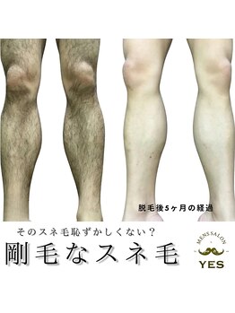 イエス 東京池袋店(YES)/足脱毛