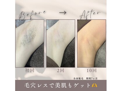 モア トゥインクル 倉敷店(MORE twinkle)の写真