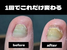 ネイルズ ヴォロンティエ(Nail's Volontiers)
