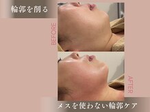 エフリア 大垣(F.lia)の雰囲気（高周波の圧倒的出力で深部へアプローチ！）