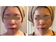 スパ アールアンドビー(SPA*R&B)の雰囲気（骨格スリム★頭皮から引き上げる★老化による顔のタルミ歪み◎）