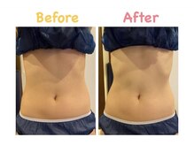 クレビア 麻布十番(CREBIA)/【痩身/代謝促進】