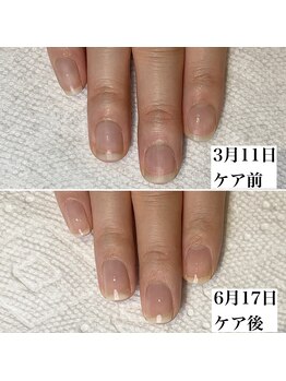 コロレ(colore)/美爪育成コース