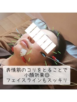 ココロ(CoCoLo)/美容鍼灸 効果