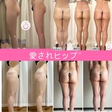 ヨサパーク ハナ(YOSA PARK)