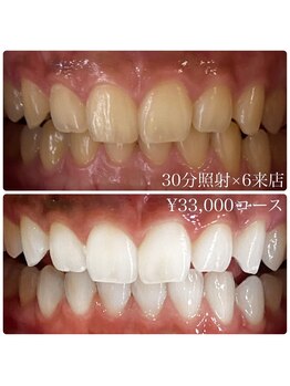 ホワイトニングルーム 川崎店(WhiteningRoom)/ホワイトニング/川崎