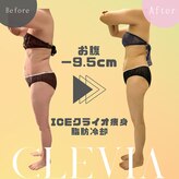 クレビア(Clevia)