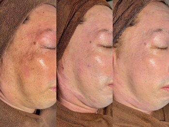 ルーナジェーナ(Luna llena)/