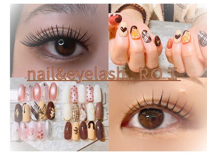 ロイ(ROI)の写真