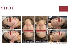 スプレール 水戸店/RED SHOT レッドショット