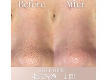 ステラティエ(Stellatier)の雰囲気（サロン施術部屋お子様は隣のリビングにてお待ちいただけます）
