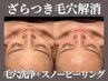 【その毛穴諦めないで】角栓/黒ずみ対策毛穴洗浄+韓国スノ-ピーリング¥4620★