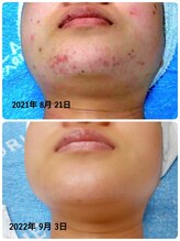 りりあす/お手入れ次第でお肌は変わります