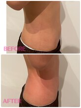 ウナ デ リンゴル 恵比寿店(UNA de Ringol)/初めてのボディ痩身はこちら！