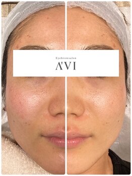アイブロウサロン アヴィ(A‘VI)/右側のフェイスラインに注目