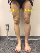 シャルム(Charme)/脚スッキリ