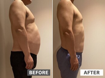 ケードット カシェットプラス(K.CACHETTE+)/ウィンバック　ビフォーアフター