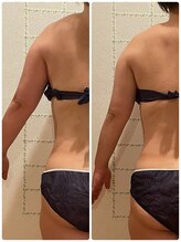 ヨサパーク エスポワール 三木店(YOSAPARK Espoir)/劇的変身コースビフォーアフター