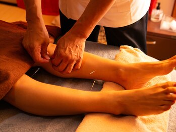 サロンラメール(Salon Lamer)/鍼灸/美脚作り!足の重さむくみに