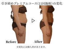 ヨサパーク マカナ 那珂湊店(YOSA PARK)