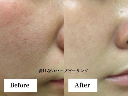 スキンセラピーサロン ル クレール(Le Clair)の写真