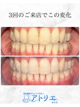 アトリエ 横浜店/ホワイトニングサロン/横浜