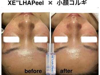 ロージースマイル(Rosy smile)/【韓国肌管理★ セラピール 】