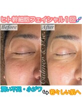 カルマーアンドビー(Calmer & Be.)&nbsp;肌再生 美白