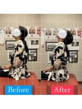 ナオル整体 宮崎院(NAORU整体)/40代女性施術事例【肩こり改善】