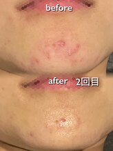 リイル バイ クレビア(REILE by Crebia)/お客様写真