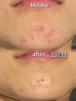 リイル バイ クレビア(REILE by Crebia)/お客様写真