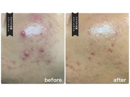 サロン フェリシア(salon Felicia)の写真