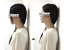 美助(bisuke)/巻き肩ケアのお写真