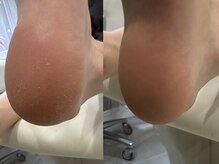 ネイル スパ ココプラス(Nail spa Cocoplus)/フットケア 角質ケア 30分コース