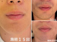 レジーナビューティー(Regina Beauty)の雰囲気（効果をご実感いただける確かな脱毛!初回3980円、2回目以降5480円）