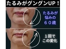 衰え肌のお悩みは私にお任せ下さい。老ける原因を知っています★