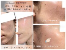 特許製法の化粧品で肌を根本改善&デコルテ/肩/首/頭皮マッサージ