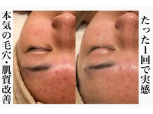 シャルム(Charme)