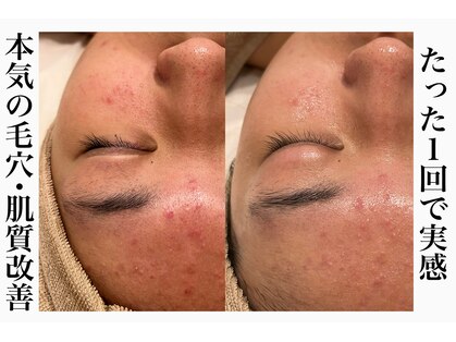 シャルム(Charme)の写真