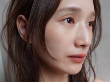 シエナ アイ(CIENA eye)/