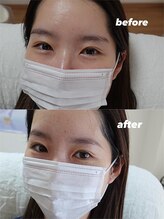 シェアリー(sharely..)/眉山で印象変わります！