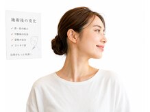 ミミ(MIMI)/首と肩をゆるめる